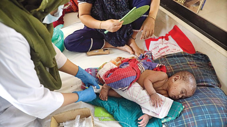 হামে দেশে ২২৩ শিশুর মৃত্যু: টিকা ও কিট ভ